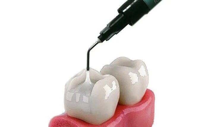 Dental Composite