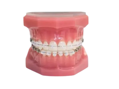 Dental-Straight-Wire